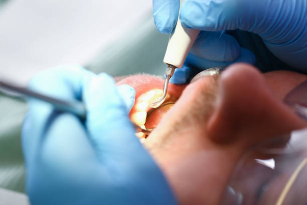 Best Urgent Tooth Repair  in Athens, OH