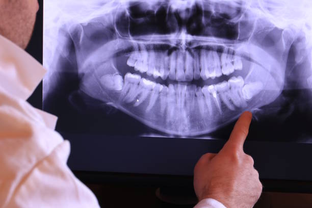 Best Knocked-Out Tooth Emergency  in Athens, OH