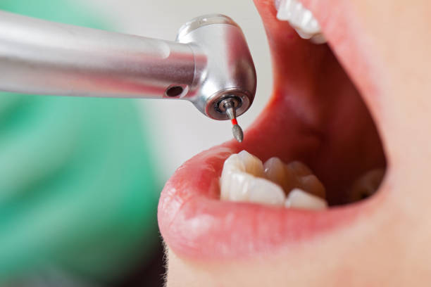 Best Cracked Tooth Emergency Dentist  in Athens, OH